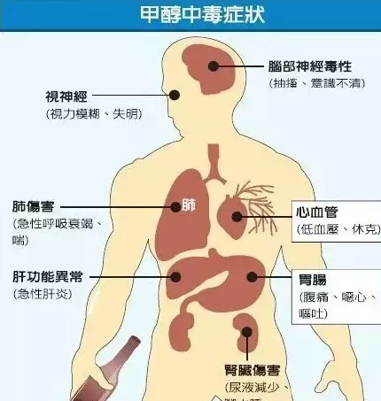 开云体育网页版登入
后期中毒症状